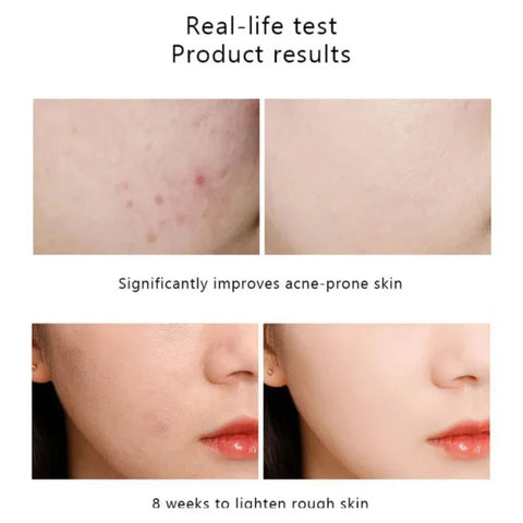 best for skin